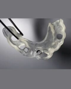 Cirugía Guiada e Implantes Dentales