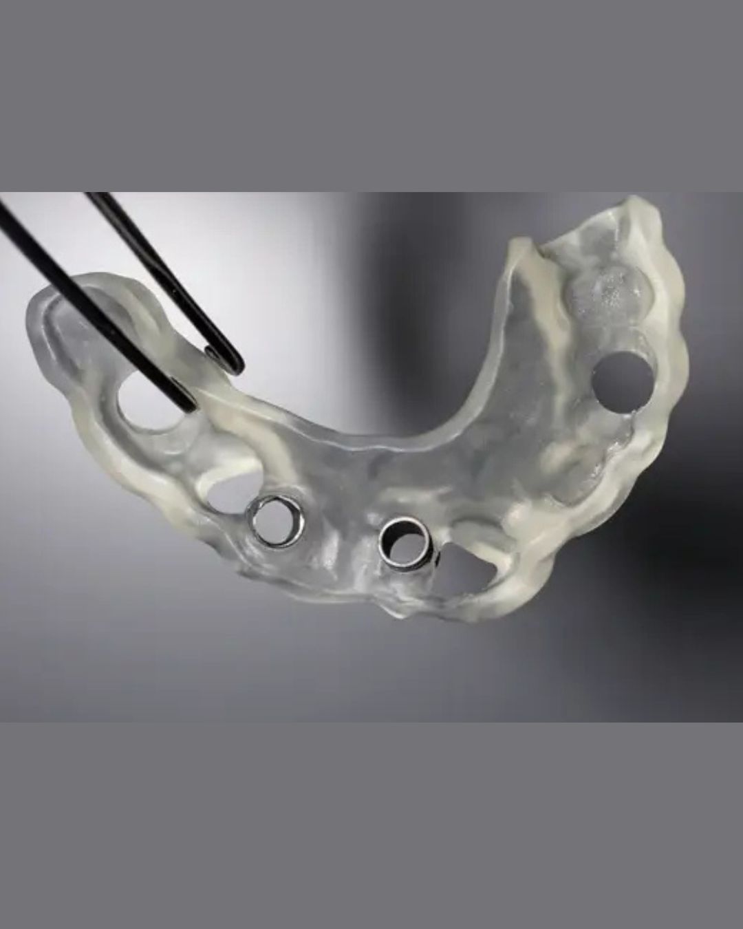 Cirugía Guiada e Implantes Dentales