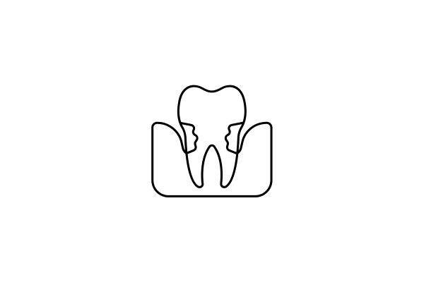 Periodoncia en San Sebastian de los Reyes