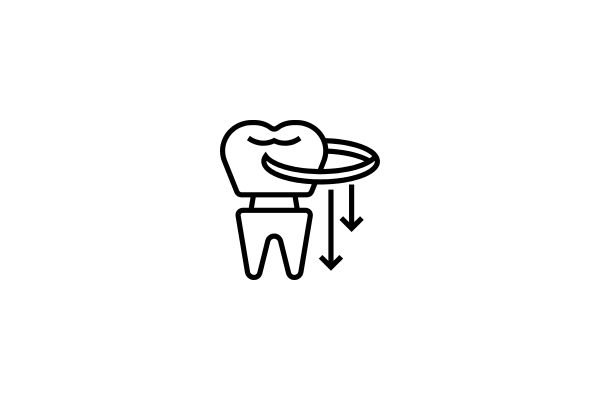 Prótesis Dental_San Sebastian de los Reyes
