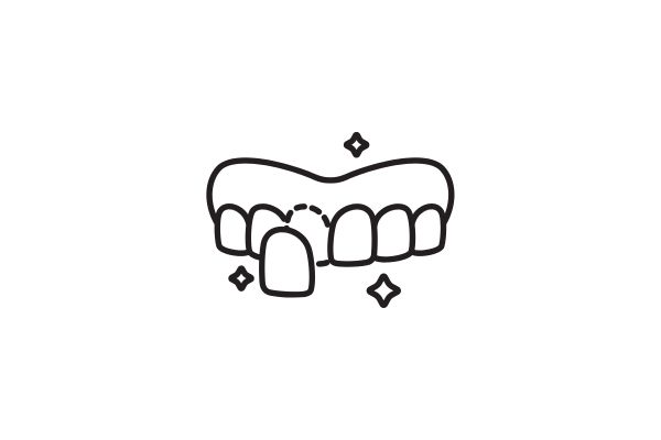 Estética Dental_San Sebastian de los Reyes