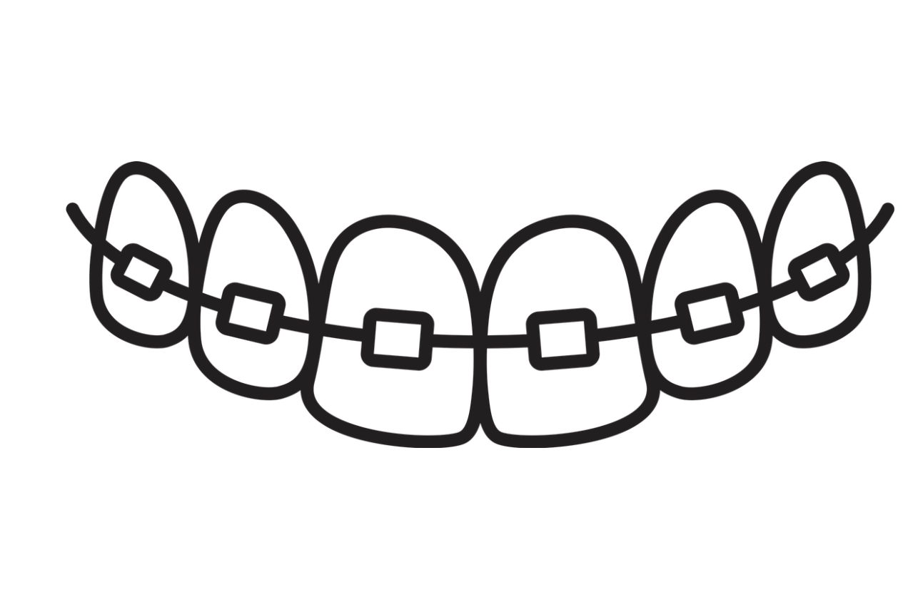 Ortodoncia Brackets